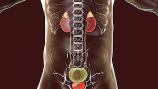 Prostate cancer diet: symbolic image