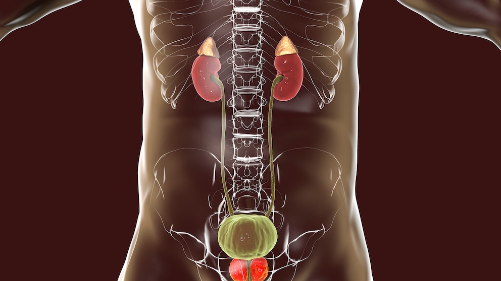 Prostate cancer diet: symbolic image