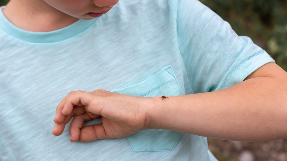 Tick Alert: Child with Tick on Arm