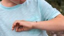 Tick Alert: Child with Tick on Arm