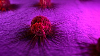 thymus cancer: Cancer cell