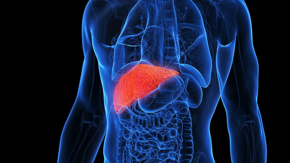 Preventing Fatty Liver Through Diet