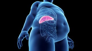 Obesity Illustration