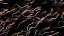 Sperm Quality and Count Decline