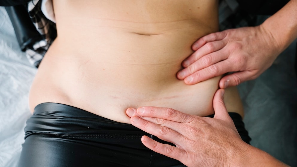 Kegel Exercises for Pelvic Floor Training