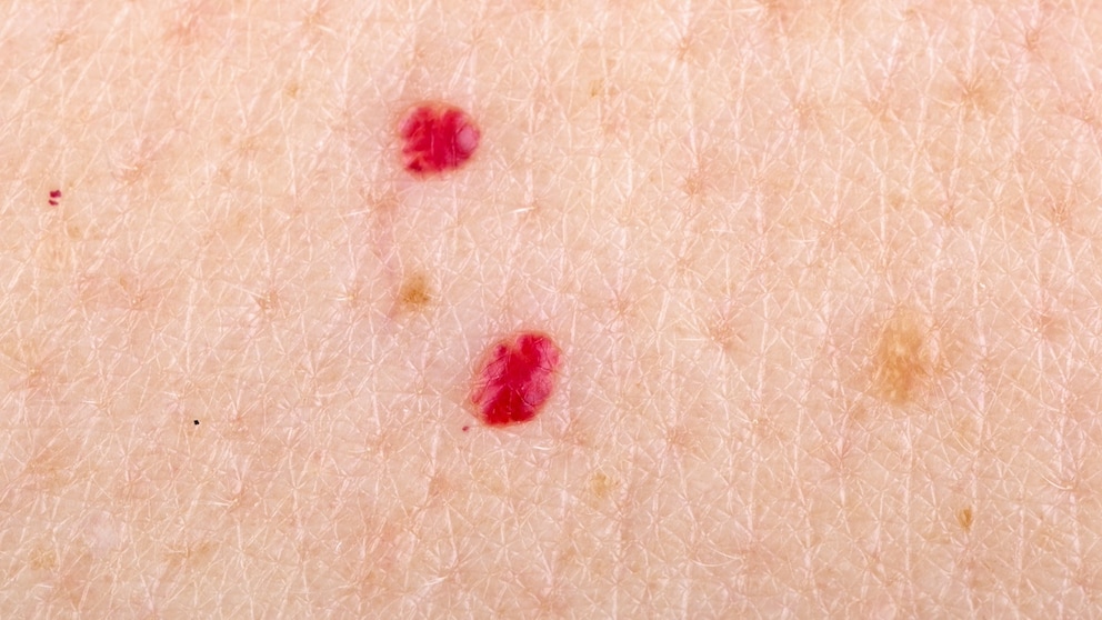 What do red spots on the skin mean?