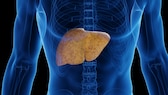 There are things that are harmful to the liver