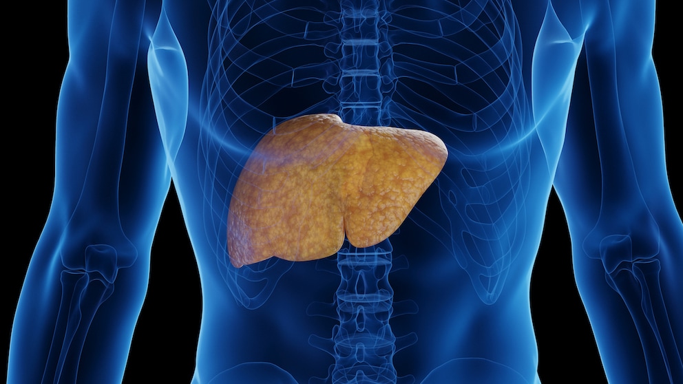 There are things that are harmful to the liver