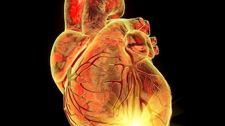 There are various factors for heart disease
