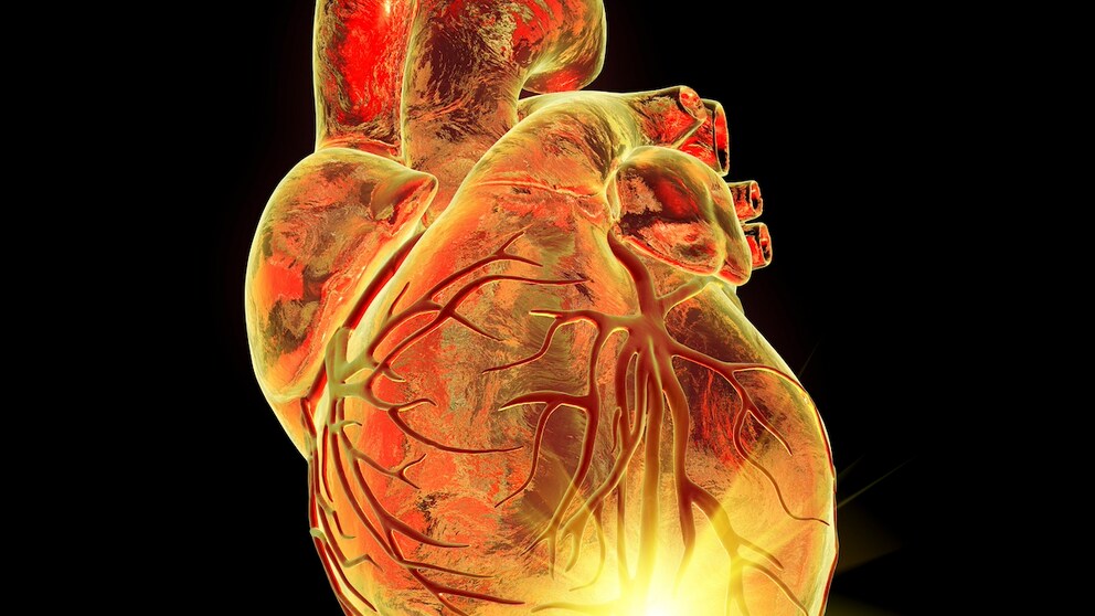 There are various factors for heart disease