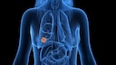A change in weight influences the risk of breast cancer
