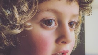 Many children suffer from an adenovirus infection.