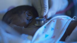 Baby With Wilms Tumor