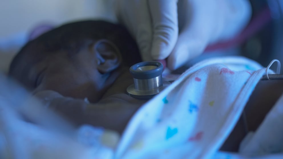 Baby With Wilms Tumor