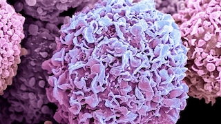 Breast cancer cells