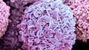 Breast cancer cells