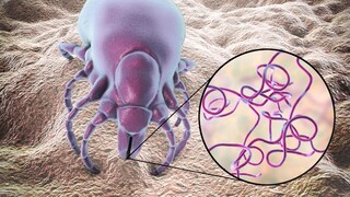 Lyme disease can be transmitted by ticks