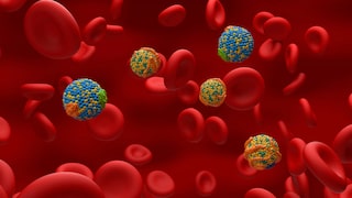 Cholesterol is said to be linked to dementia