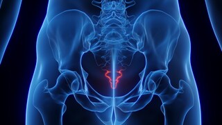 Tailbone pain