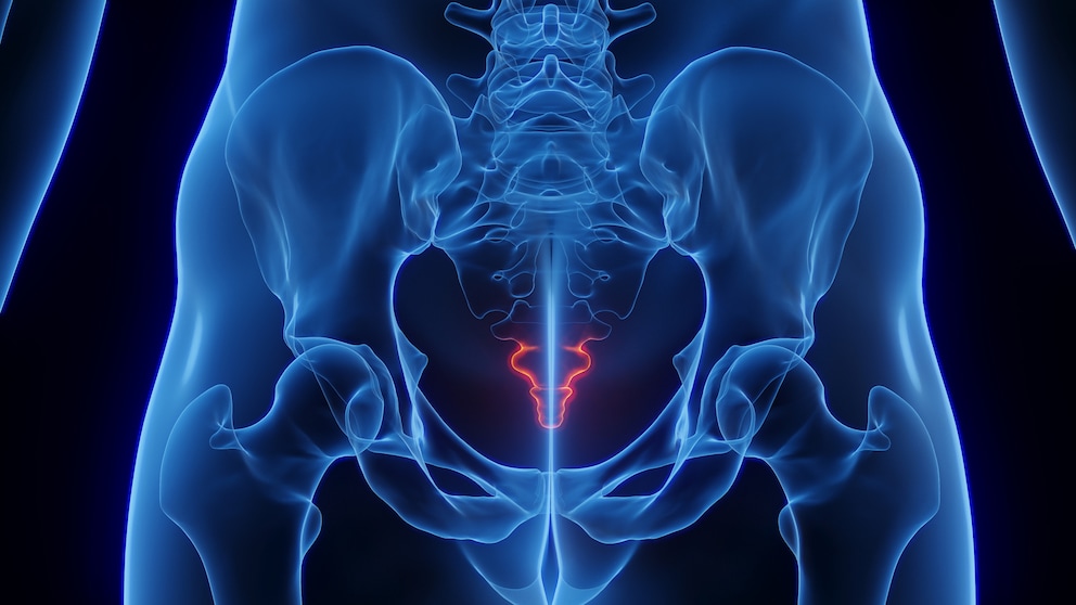 Tailbone pain