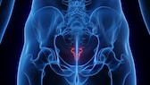 Tailbone pain