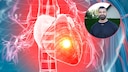 Why even trained men can suffer a heart attack