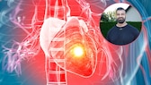 Why even trained men can suffer a heart attack