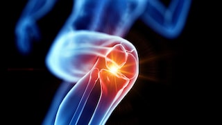 Runner's knee