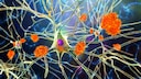 Study Finds Sitting May Contribute to Alzheimer's