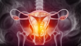 Ovarian cancer is a malignant tumor disease that forms in the ovaries.