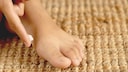 Athlete's foot can develop through small cracks in the skin when the foot is exposed to a lot of moisture.