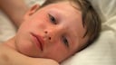 Child with Sunburn