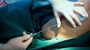 Lipedema can cause significant pain and is often misdiagnosed; now, health insurance covers liposuction.