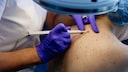 Skin Cancer Herpes
