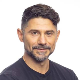 Deltoid muscle (deltoid muscle): Anatomy, function, exercises - FITBOOK