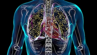 Tuberculosis has become rare in Germany, but the numbers are rising. The outcome of the disease is particularly life-threatening.