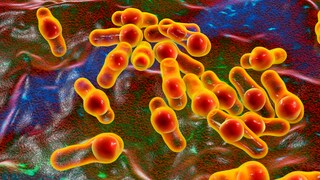 Botulism