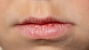 Lip Color Changes Can Be a Warning: What Bluish, Chapped, or Pale Lips May Indicate