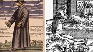 The fact that the plague has not been completely eradicated is demonstrated by a recent case in the U.S.–an infection with the pathogen Yersinia pestis was confirmed in a person there.