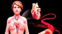 Heart Attack in Women