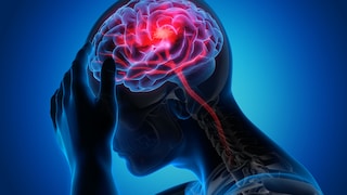 Daylight Saving Time Increases Risk of Strokes