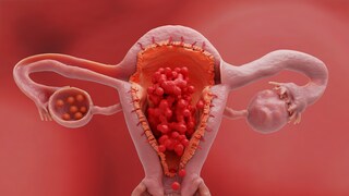 Does Estrogen Protect the Heart?
