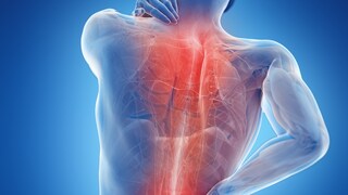 Nonspecific back pain can be excruciating