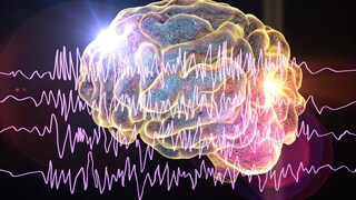 Epileptic Seizure