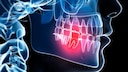 Tooth Pain Worse at Night