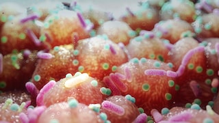 Probiotics naturally occur in fermented foods. A deficiency of these "good" gut bacteria can have serious consequences.