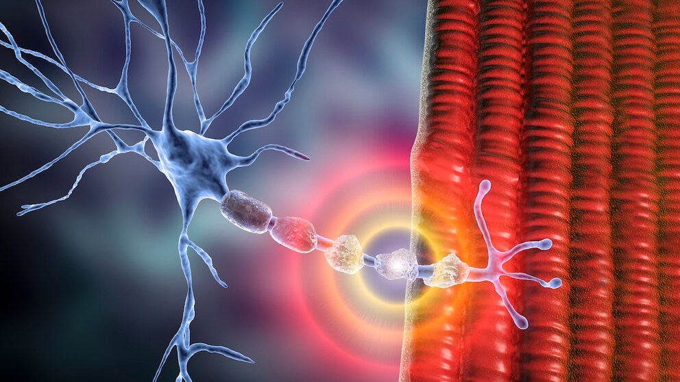New Factor Identified for Multiple Sclerosis