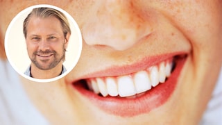 Young Teeth