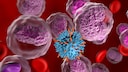 Cancer can be linked to diet, among other factors.