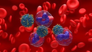 PFAS May Be Linked to Leukemia